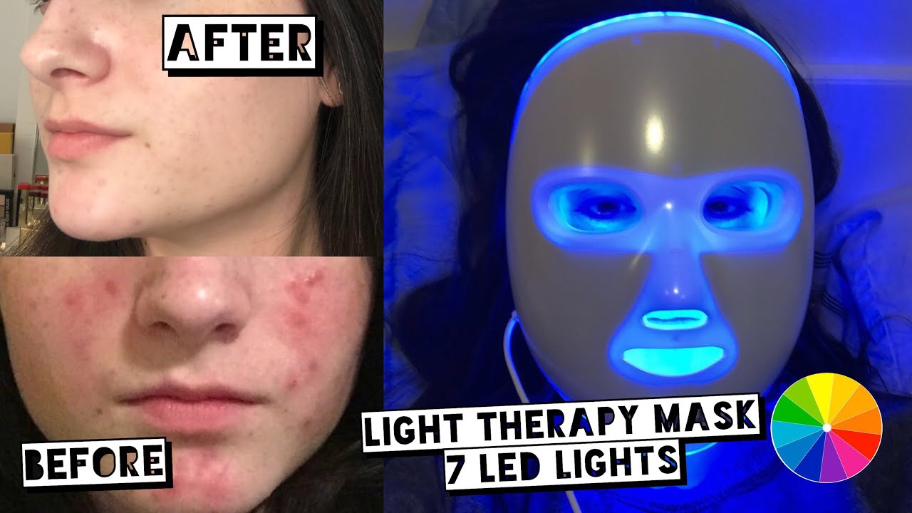 TESTING LED LIGHT THERAPY MASK FOR ACNE | PROJECT E BEAUTY LED ...