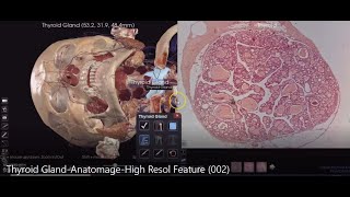 Thyroid Gland on Anatomage Table