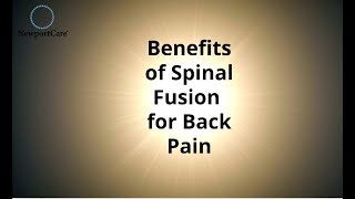 Benefits of Spinal Fusion for Back Pain