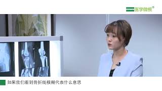 骨折后影像学检查可见骨痂形成、骨折线模糊是什么意思？