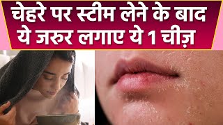 स्टीम लेने के बाद चेहरे पर लगाएं ये 1 चीज, Steam के बाद Face पर क्या लगाना चाहिए | Boldsky *Health