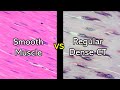 Practice | Smooth Muscle vs Dense Regular Connective Tissue