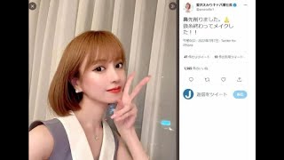 元キャバ嬢モデルが整形報告「鼻先削りました」　術後写真にファン絶賛「さらに綺麗に」【セレブニュース】