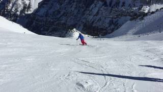 Skiing 3 months after Knee Replacement Surgery with Dr. Richard Berger