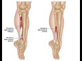 Two Minutes of Anatomy: Lateral Lower Leg Muscles - Peroneus Longus & Peroneus Brevis