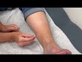 mcmaster medical acupuncture program sp 6