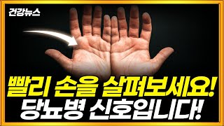 손에 이것이 있다면 당장 병원부터 가세요! 당뇨병과 폐에 이상 신호일 수 있습니다!