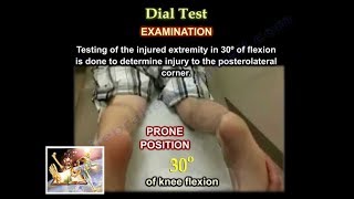 Dial Test - Everything You Need To Know - Dr. Nabil