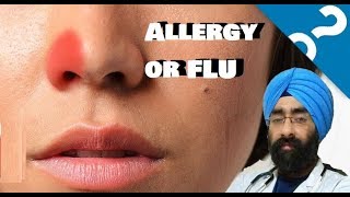 is it a cold allergy or a viral flu | Dr.Education (Hin)