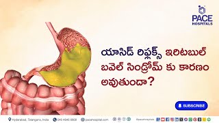 యాసిడ్ రిఫ్లక్స్ ఇరిటబుల్ బవెల్ సిండ్రోమ్ కు కారణం అవుతుందా? | #ibs