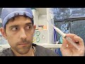 How long does it take anesthesia to leave your body? Dr. Kaveh LIVE