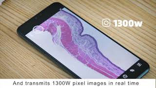 TIPSCOPE Microscopic Camera 2μm Resolution 13 Million Pixels