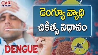 డెంగ్యూ వ్యాధి చికిత్స విధానం | Treatment Of Dengue Disease | Health Tips | CVR Health