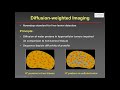 Liver metastases : what the radiologist needs to know, W Schima