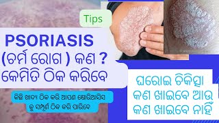 What is psoriasis(ଚର୍ମ ରୋଗ)?Tips and Home remady,ଷୋରିଆସିସ କଣ ? ଘରୋଇ ଚିକତ୍ସା ,କଣ ଖାଇବେ,କଣ ଖାଇବେନି