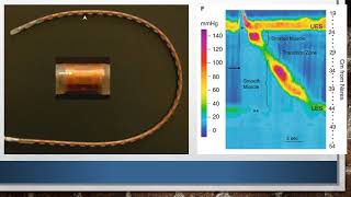 High resolution oesophageal manometry - Part 1 - An overview of manometry