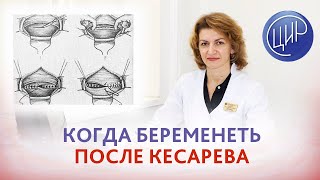 Беременность после кесарева сечения. Когда беременеть после кесарева? Дементьева С.Н.