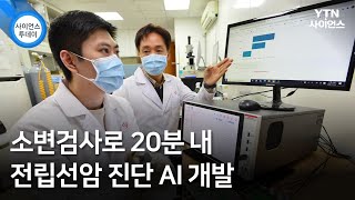 소변검사로 20분 내 전립선암 진단 AI 개발 / YTN 사이언스