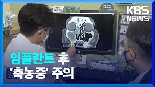 임플란트 심고 누런 콧물…‘임플란트 축농증’ 주의보 / KBS  2023.09.11.