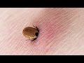 08 Most Painful and Deadliest Insects Bites in The World!