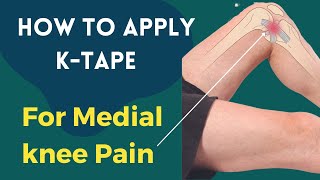 How to treat Medial knee Pain (MCL Sprain / Medial Meniscus) with Kinesiology Tape