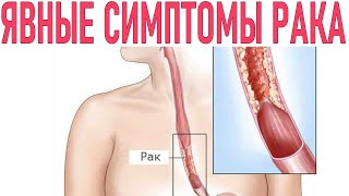 ОНКОНАСТОРОЖЕННОСТЬ | Как вовремя самому не пропустить опасные симптомы