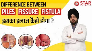 Difference between piles, fissure and fistula पाइल्स, फिशर और फिस्टुला में अंतर Laser लेज़र Punjab