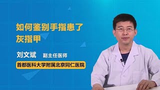 如何鉴别手指患了灰指甲 刘文斌 首都医科大学附属北京同仁医院