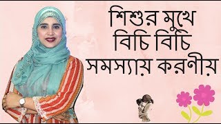 শিশুর মুখে বিচি বিচি সমস্যায় করণীয় | Nutritionist Aysha Siddika | Kids and Mom