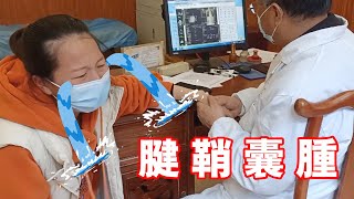 【鄧石頭】手背上長了一個腱鞘囊腫，痛的我懷疑人生