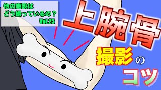 コツは肘と身体の向き！！上腕骨2方向の撮影法！！～おまけ付き　三角巾で腕を吊ったVer.～　 一般撮影・レントゲン  ほかの施設はどう撮ってるの？！シリーズその２５