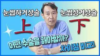 눈썹하거상술이 필요한 눈과 눈썹상거상술이 필요한 눈은 뭐가 다를까? 차이점 비교!