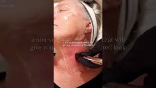 Sculpting Jawline And Cheekbones with This Treatment #skintightening