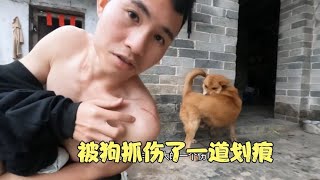 农村小伙被狗抓伤之后，他居然不去打狂犬疫苗，会患上狂犬病毒吗