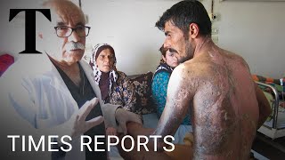 Exclusive evidence of white phosphorus use in Syria | Times Reports