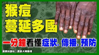 「猴痘」是什麼？猴痘症狀、傳播途徑、預防方法一次看！｜新聞知識站｜霸氣太陽聯播