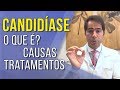 O que é a #CANDIDÍASE ? | Quais as suas causas e tratamentos? | Dr Victor Sorrentino