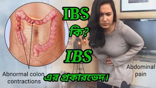আইবিএস কি?(আইবিএস এর প্রকারভেদ) (বিরক্তিকর পেটের সমস্যা) what is IBS. (irritable bowel syndrome)