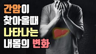 침묵의 장기, 간암초기증상과 대표증상으로 빠르게 대응합시다~(예방법도 확인하세요.)