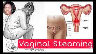 VAGINAL STEAMING AFTER CHILDBIRTH | EPISODE 29 #BLESSINGNJOH