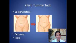 How Do I Get Rid of Extra Tummy Skin - Tummy Tuck Consultation - Dr. Anthony Youn