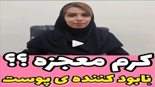 کرم معجزه ای که پوست رو نابود میکند