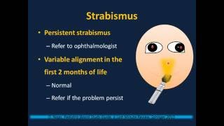 Newborn Examination Neonatology II