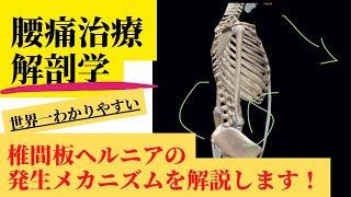 【解剖学】椎間板ヘルニアの発生メカニズムを徹底解説します！