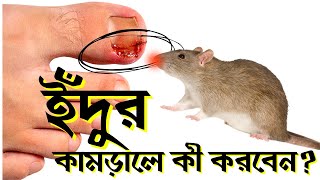 ইঁদুরে কামড়ালে কী হয়? | What happens if rat bites Us?