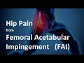 Hip Pain from Femoral Acetabular Impingement (FAI) - What is it and how to treat it?