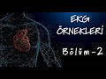 100 EKG Örneği Bölüm - 2