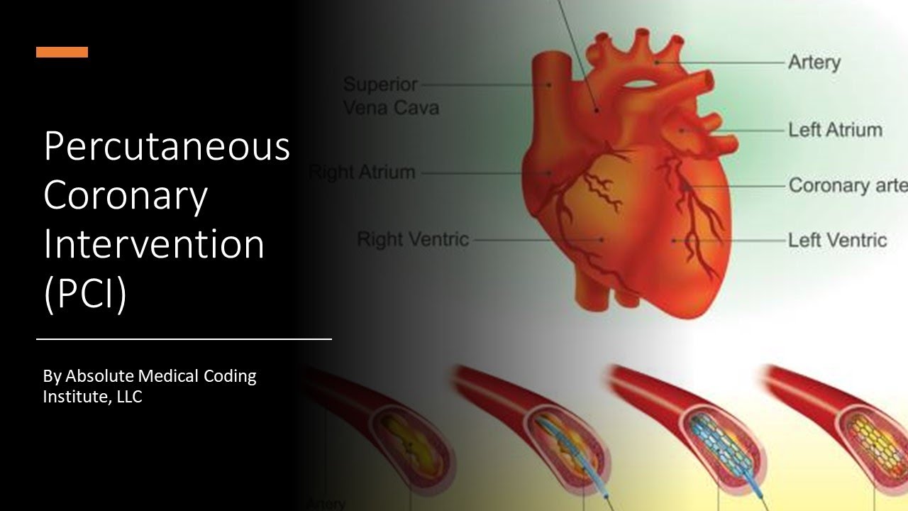 CPT Medicine Section: Percutaneous Coronary Intervention (PCI) Coding ...