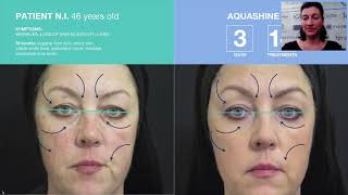 WEBINAR AQUASHINE BTX - Hydratácia-Depigmentácia-Rekonštrukcia Relaxácia pleti v estetickej medicíne