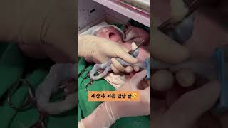 출산#shorts #쇼츠 #vlog #baby #출산 #beautiful #브이로그 #일상 #제왕절개